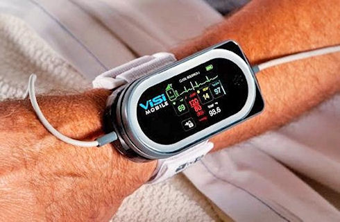 ViSi Mobile Monitor – удаленный помощник врача